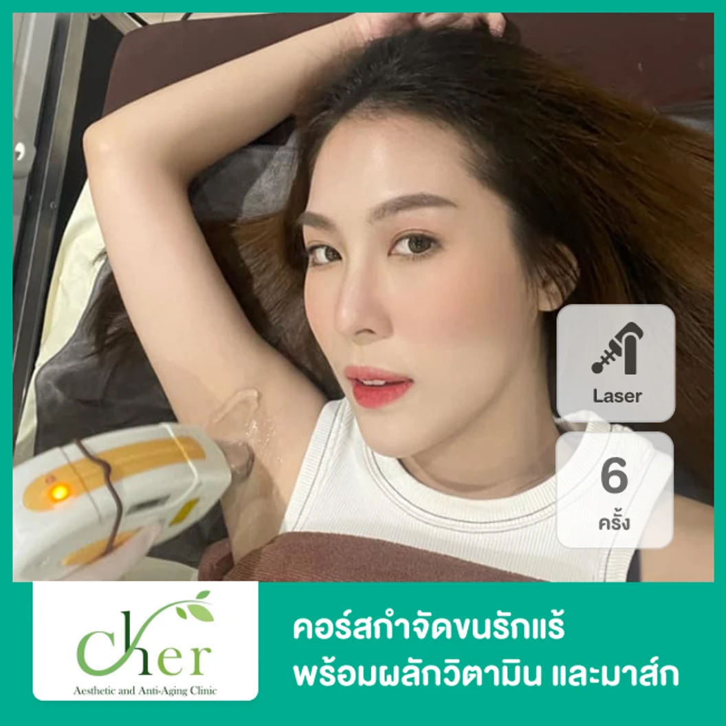 คอร์สเลเซอร์ Diode กำจัดขน + ผลักวิตามิน + มาส์กปรับสีผิวรักแร้ 6 เดือน 6 ครั้ง