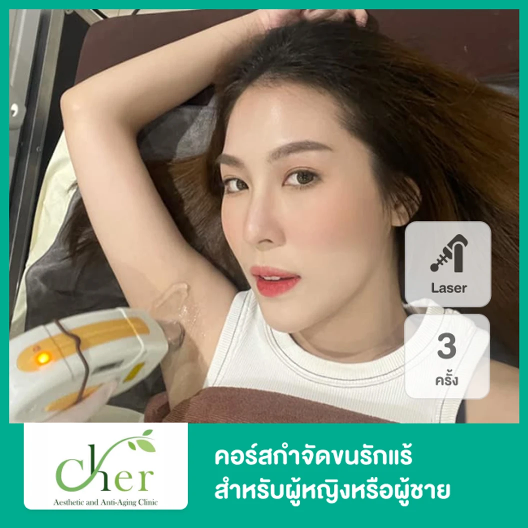 คอร์สเลเซอร์ Diode กำจัดขนรักแร้ 3 เดือน 3 ครั้ง