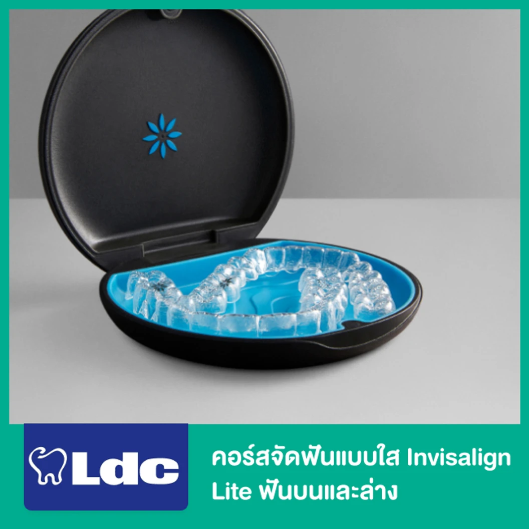 คอร์สจัดฟันแบบใส Invisalign Lite ฟันบนและล่าง
