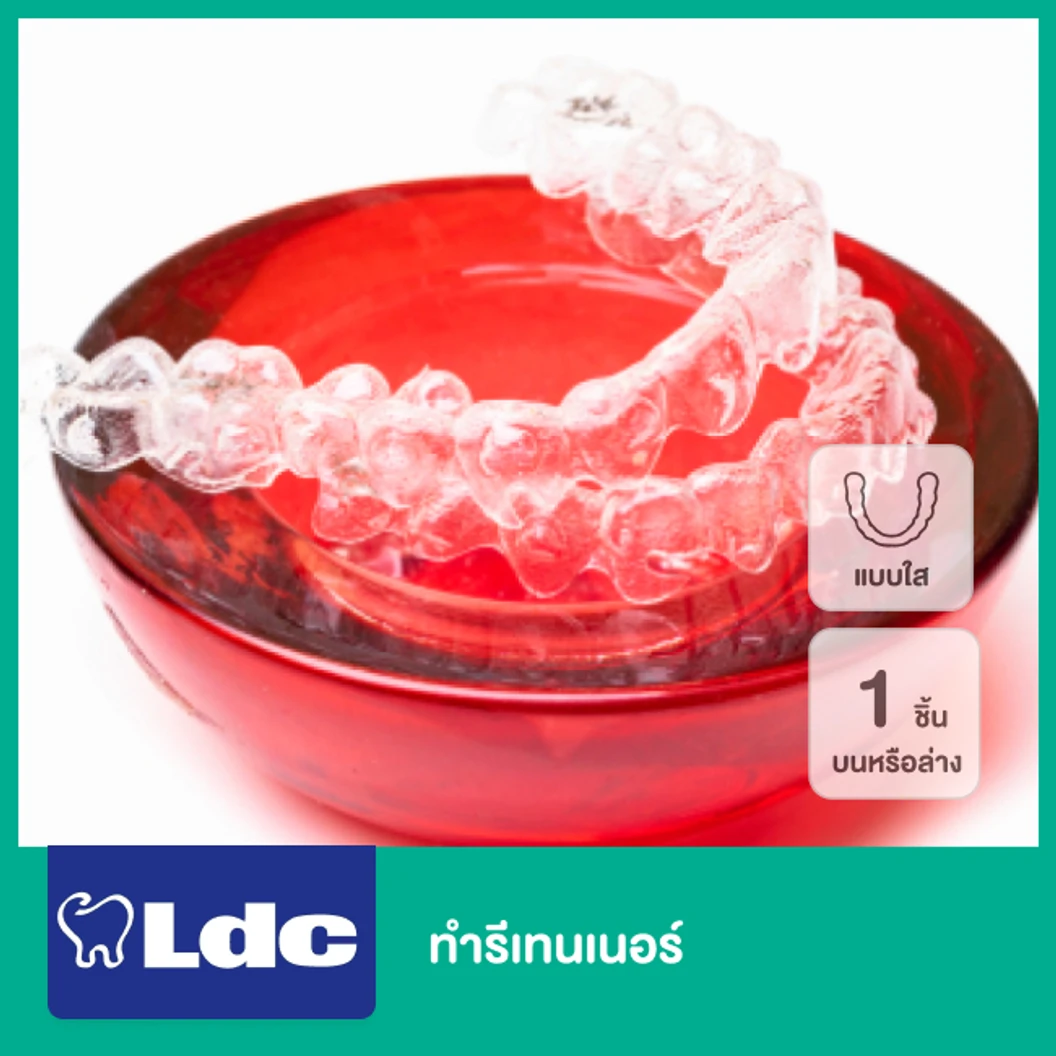 ทำรีเทนเนอร์แบบใส 1 ชิ้น (บนหรือล่าง)