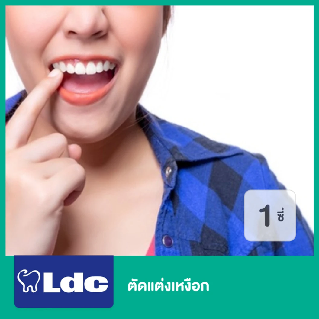 ตัดแต่งเหงือก สำหรับฟัน 1 ซี่