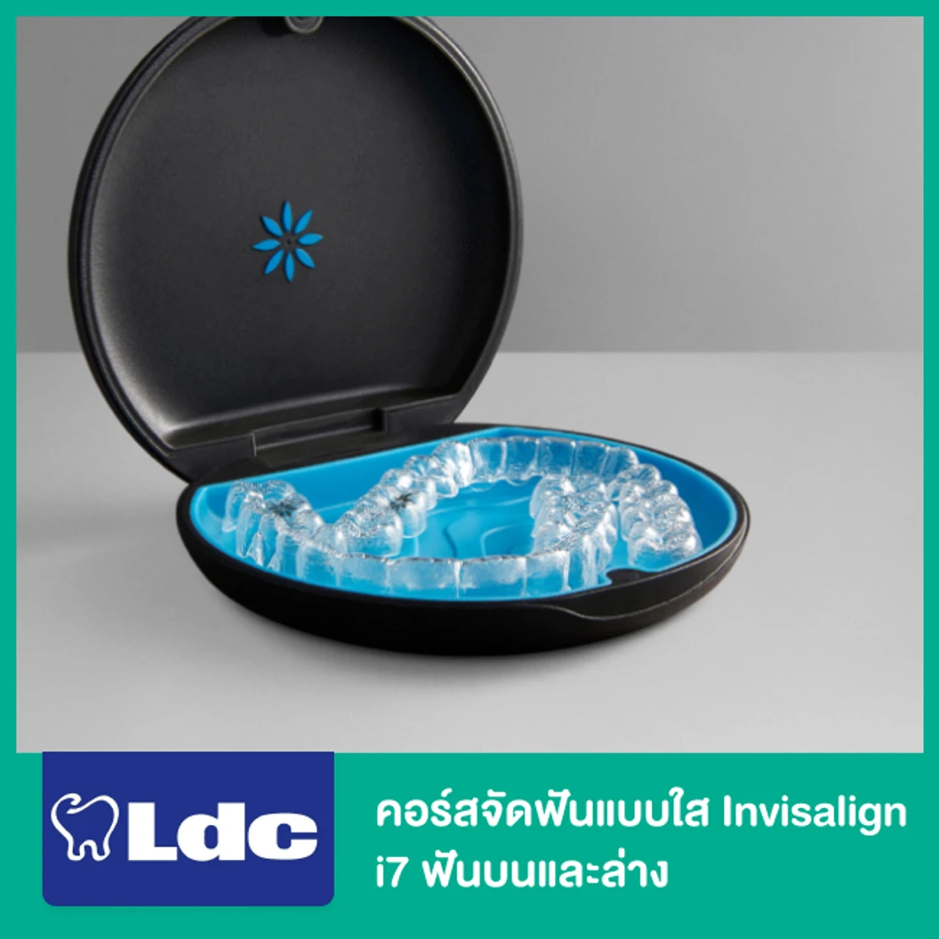 คอร์สจัดฟันแบบใส Invisalign i7 ฟันบนและล่าง