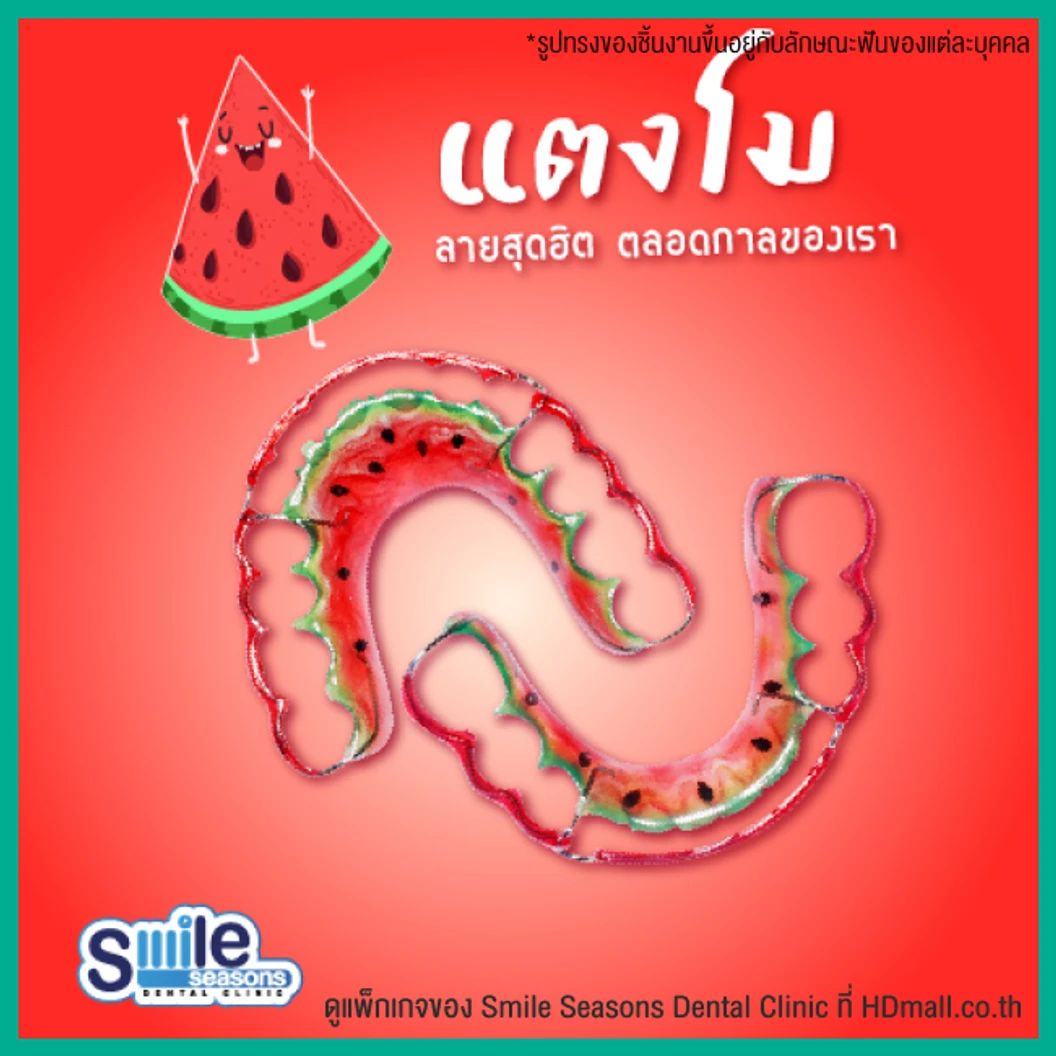 ทำรีเทนเนอร์ แบบลวด 1 ชิ้น (บนหรือล่าง) แบบสีเดียวหรือลวดเส้นเดียว