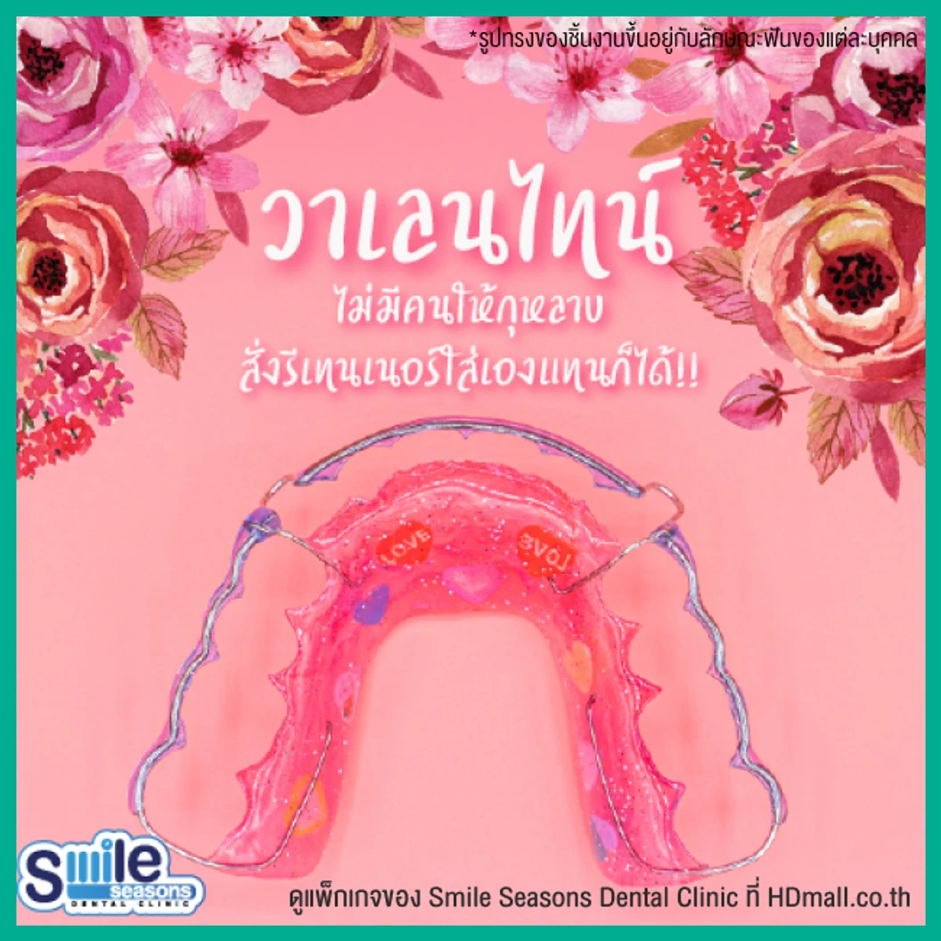 ทำรีเทนเนอร์ แบบลวด 1 ชิ้น (บนหรือล่าง) แบบสีเดียวหรือลวดเส้นเดียว