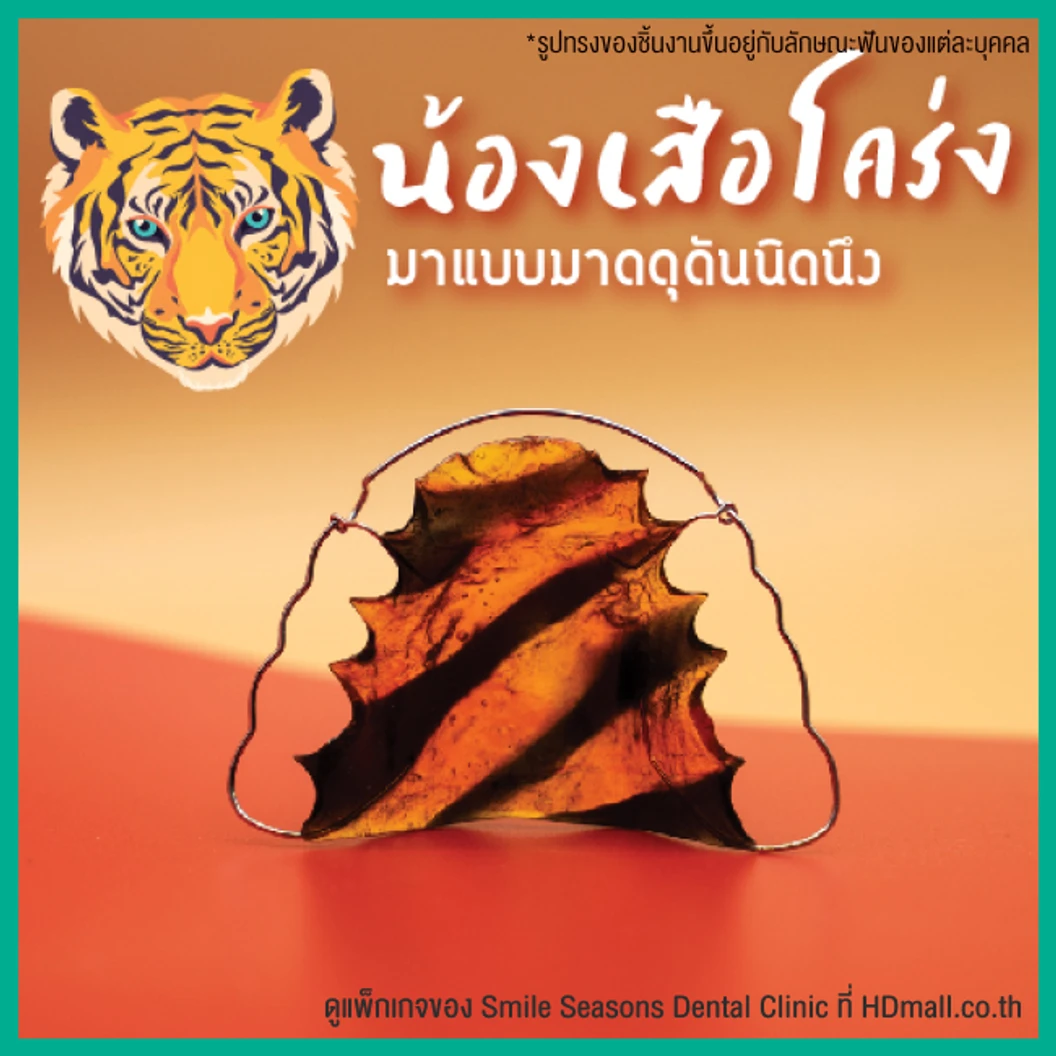 ทำรีเทนเนอร์ แบบลวด 1 ชิ้น (บนหรือล่าง) แบบสีเดียวหรือลวดเส้นเดียว