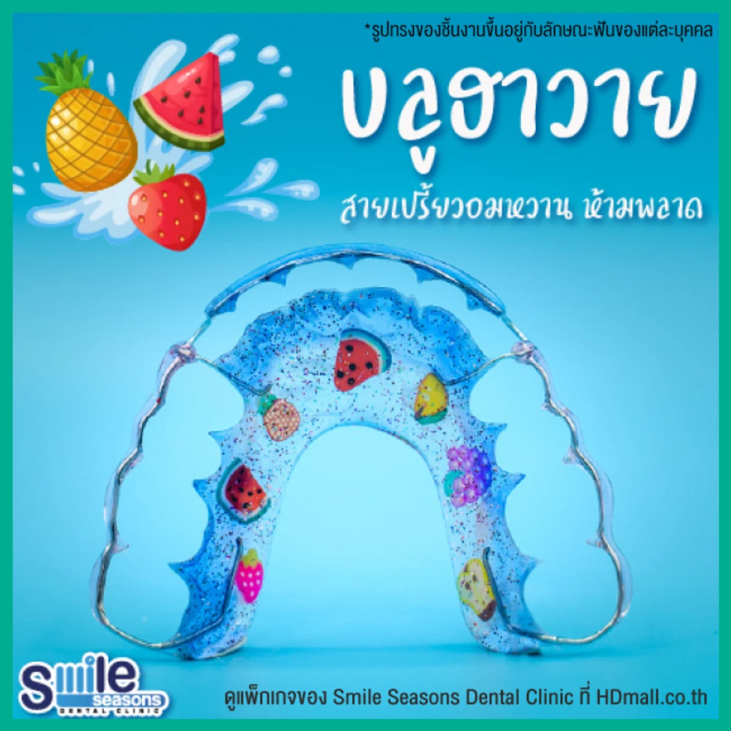 ทำรีเทนเนอร์ แบบลวด 1 ชิ้น (บนหรือล่าง) แบบสีเดียวหรือลวดเส้นเดียว