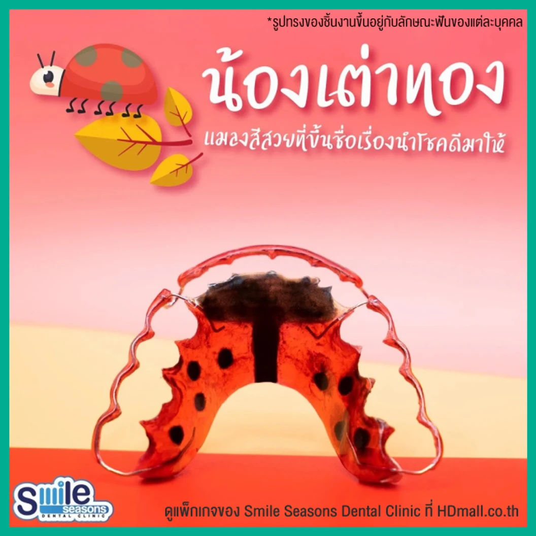 ทำรีเทนเนอร์ แบบลวด 1 ชิ้น (บนหรือล่าง) แบบสีเดียวหรือลวดเส้นเดียว