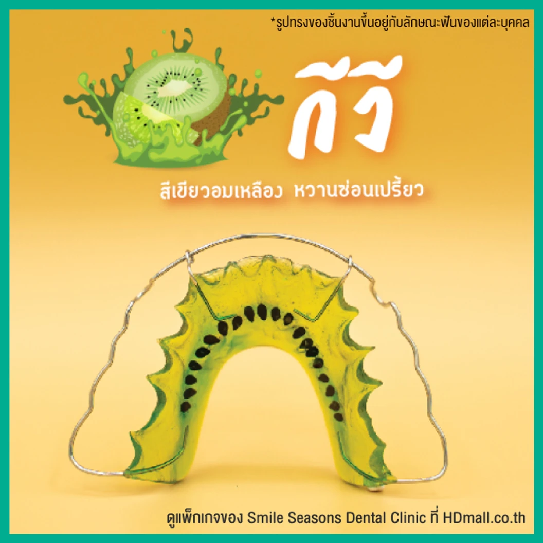 ทำรีเทนเนอร์ แบบลวด 1 ชิ้น (บนหรือล่าง) แบบสีเดียวหรือลวดเส้นเดียว