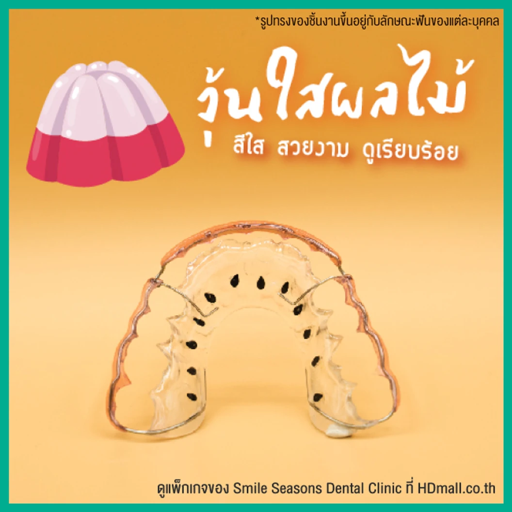 ทำรีเทนเนอร์ แบบลวด 1 ชิ้น (บนหรือล่าง) แบบสีเดียวหรือลวดเส้นเดียว