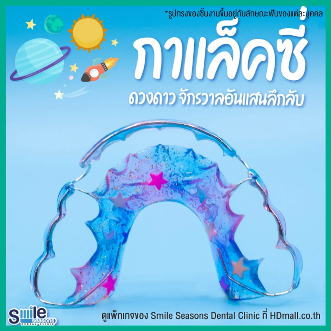 ทำรีเทนเนอร์ แบบลวด 1 ชิ้น (บนหรือล่าง) แบบสีเดียวหรือลวดเส้นเดียว
