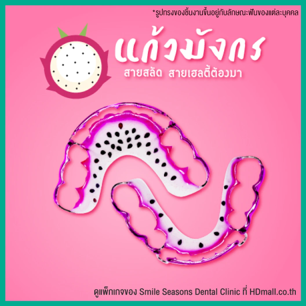 ทำรีเทนเนอร์ แบบลวด 1 ชิ้น (บนหรือล่าง) แบบสีเดียวหรือลวดเส้นเดียว