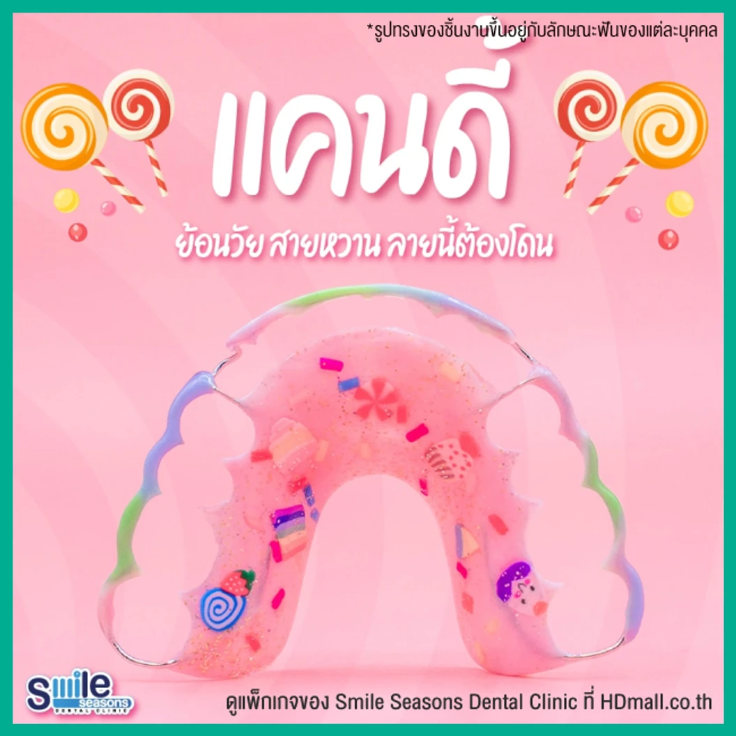 ทำรีเทนเนอร์ แบบลวด 1 ชิ้น (บนหรือล่าง) แบบสีเดียวหรือลวดเส้นเดียว