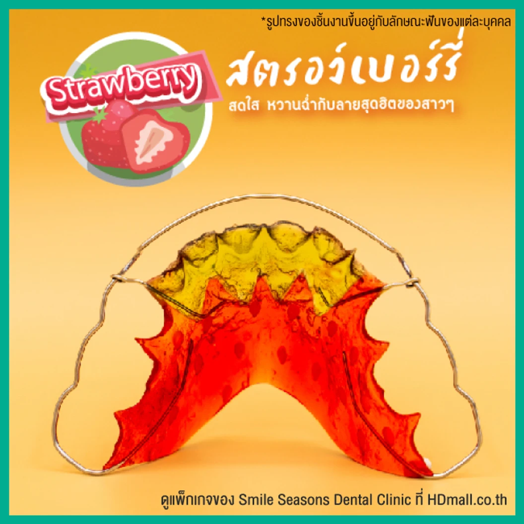 ทำรีเทนเนอร์ แบบลวด 1 ชิ้น (บนหรือล่าง) แบบสีเดียวหรือลวดเส้นเดียว