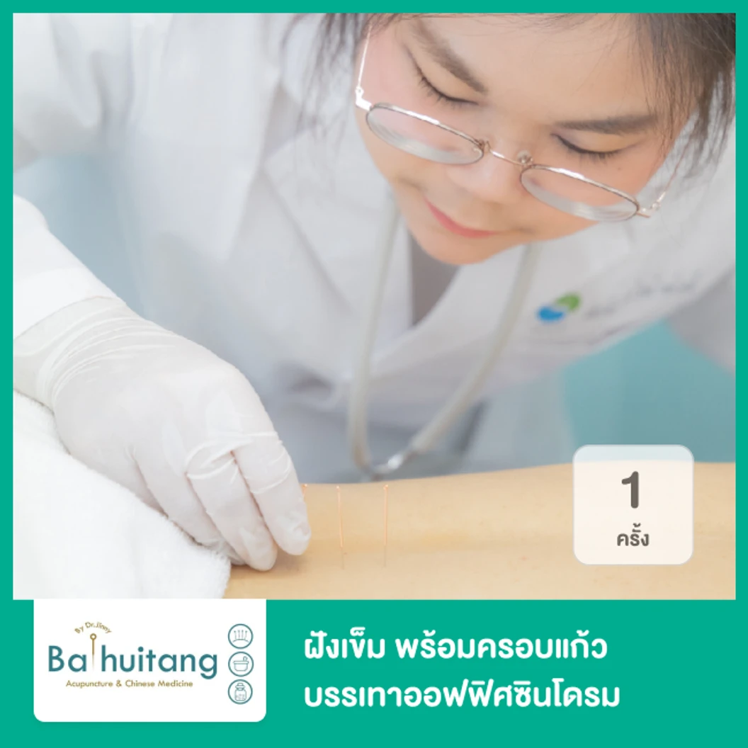 ฝังเข็ม พร้อมครอบแก้ว บรรเทาออฟฟิศซินโดรม 1 ครั้ง