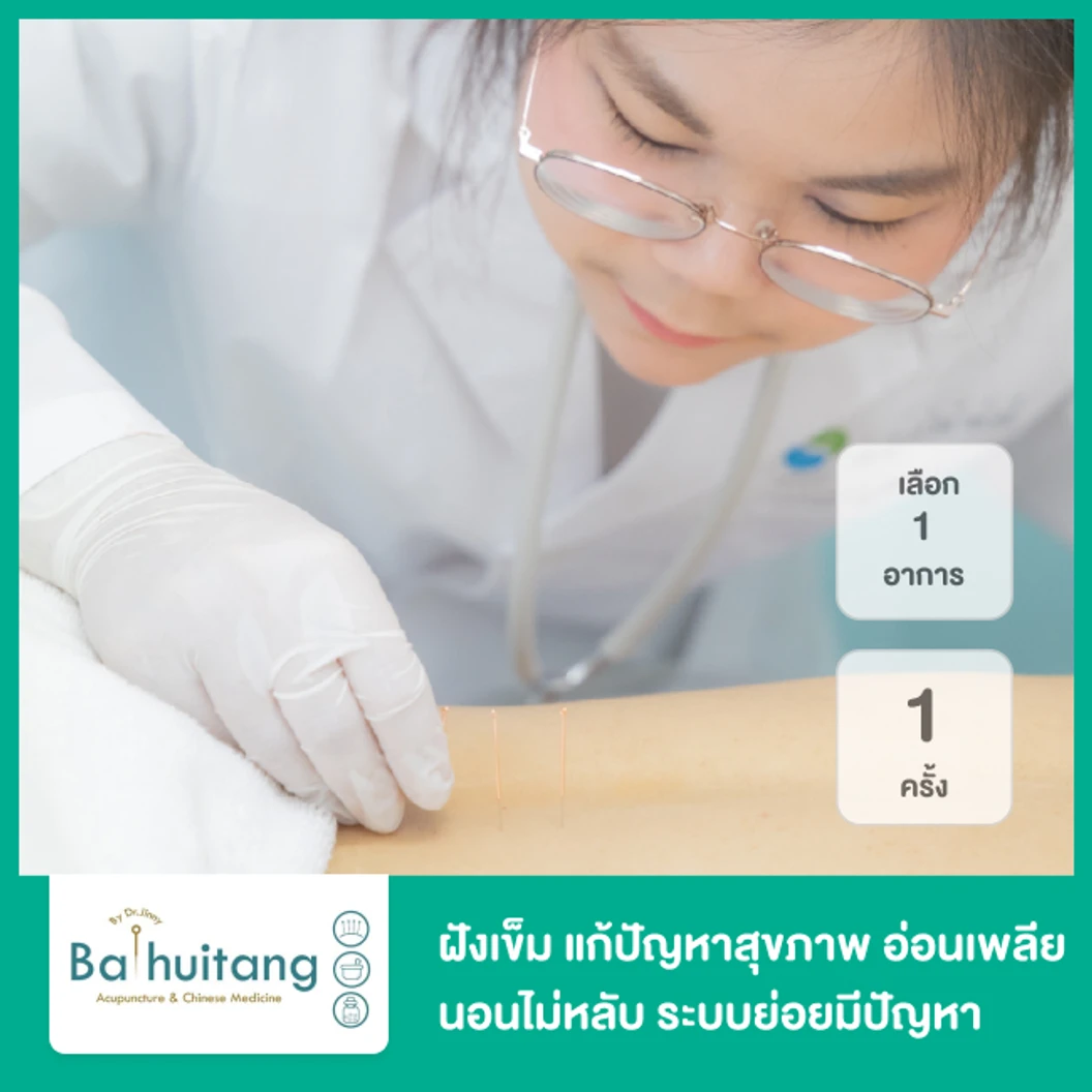 ฝังเข็ม แก้ปัญหาสุขภาพ เลือก 1 อาการ อ่อนเพลีย นอนไม่หลับ ระบบย่อยมีปัญหา อาการทางนรีเวช หรือภูมิแพ้ 1 ครั้ง