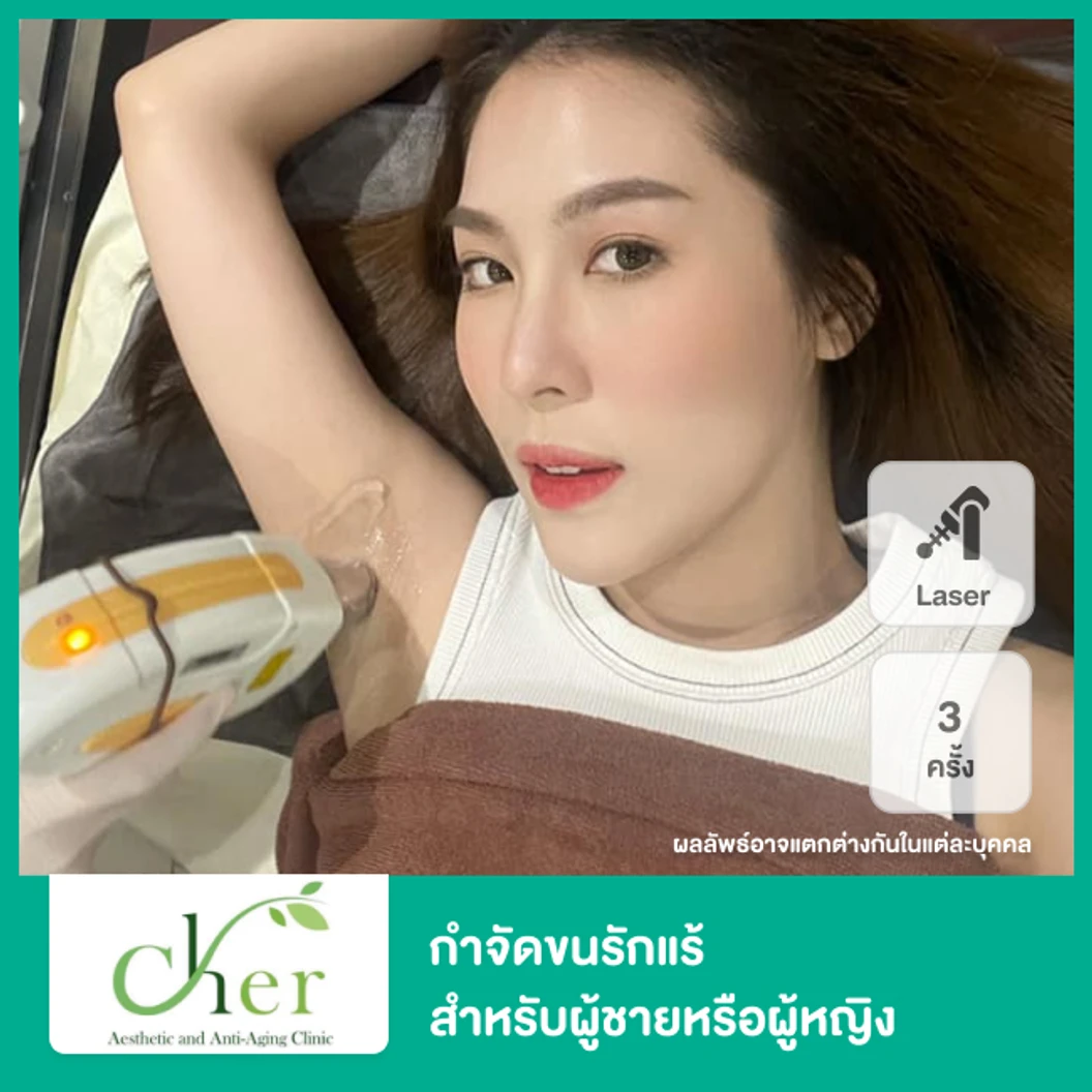 คอร์สเลเซอร์ Cool 3 Wavelength Diode กำจัดขนรักแร้ 3 เดือน 3 ครั้ง ฟรี! มาส์กปรับสีผิวรักแร้ 1 ครั้ง