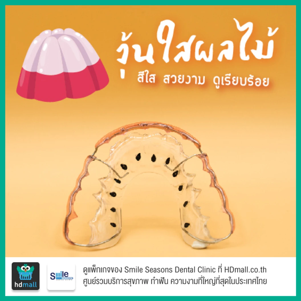 ทำรีเทนเนอร์แบบลวด 2 ชิ้น (บนและล่าง) พร้อมตรวจสุขภาพฟัน