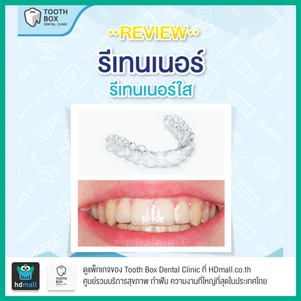 ทำรีเทนเนอร์แบบใส 2 ชิ้น ฟันบนและล่าง พร้อมตรวจสุขภาพช่องปาก