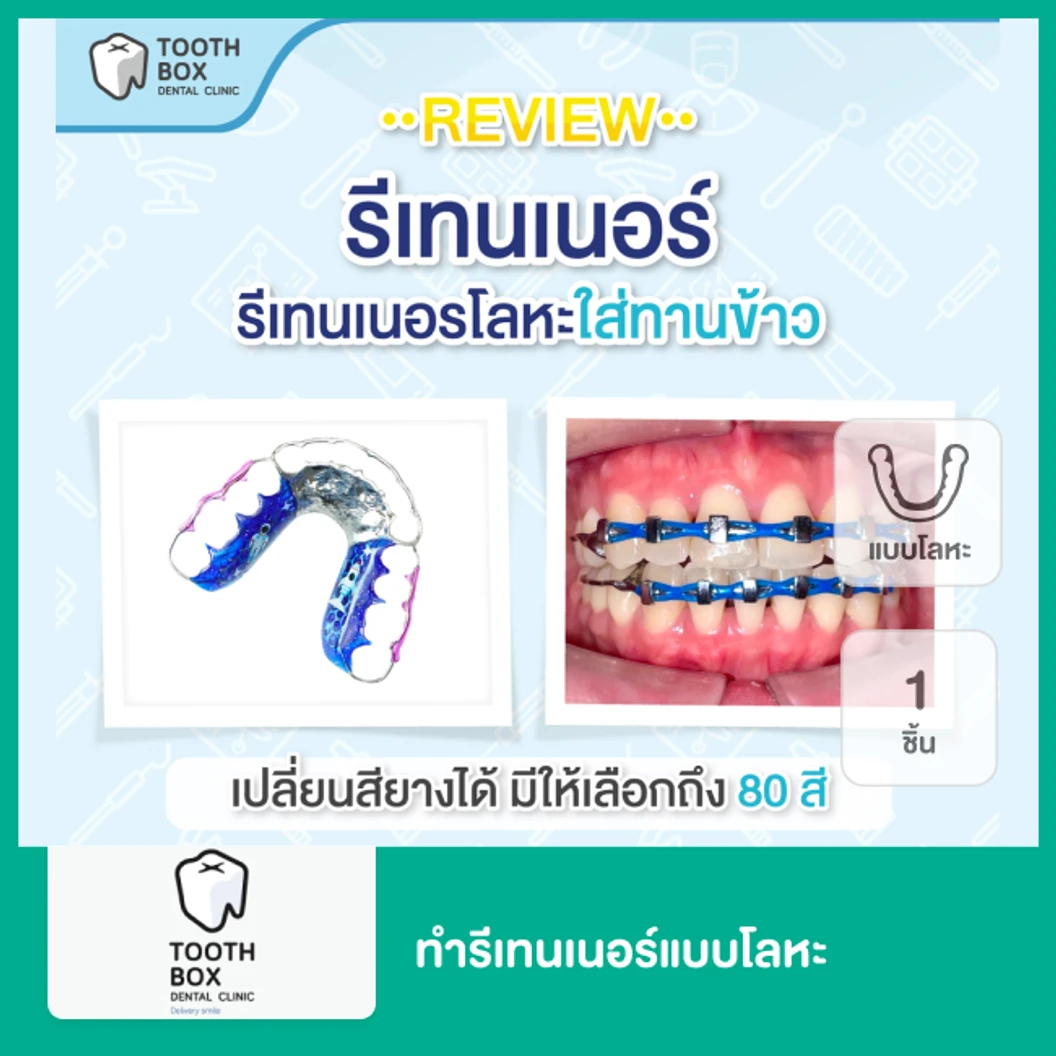 ทำรีเทนเนอร์แบบโลหะ 1 ชิ้น ฟันบนหรือล่าง
