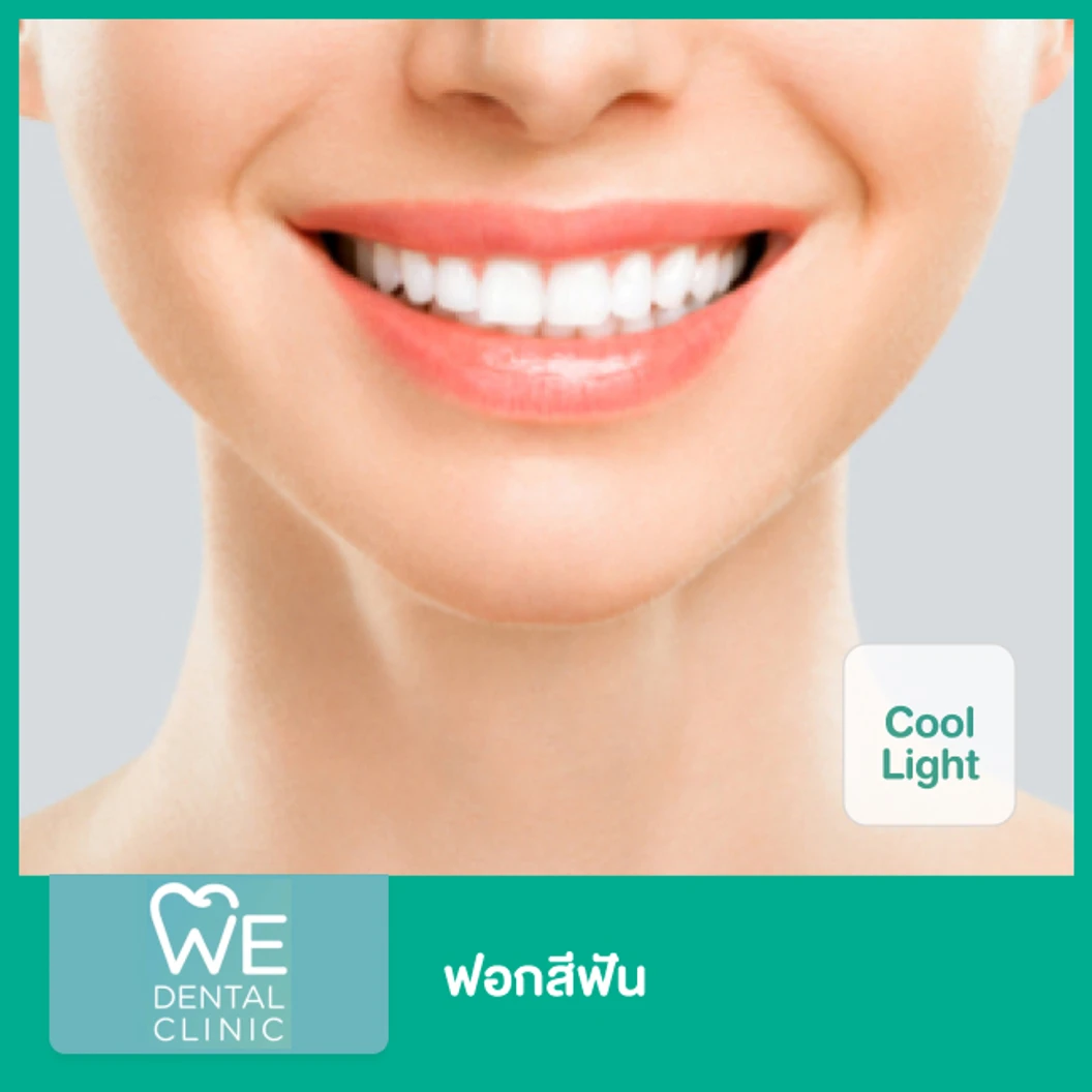 ฟอกสีฟัน ด้วยระบบ Cool Light