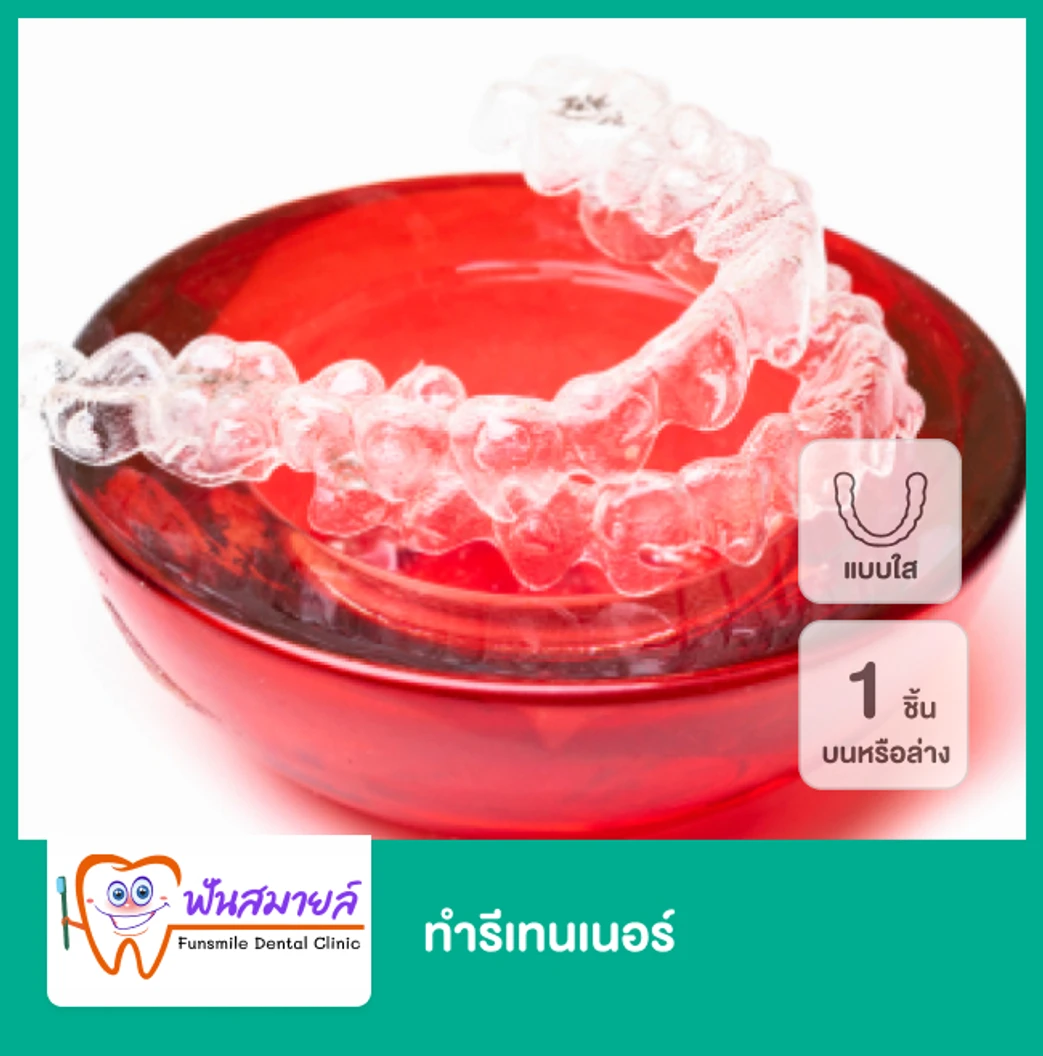 ทำรีเทนเนอร์แบบใส 1 ชิ้น ฟันบนหรือล่าง