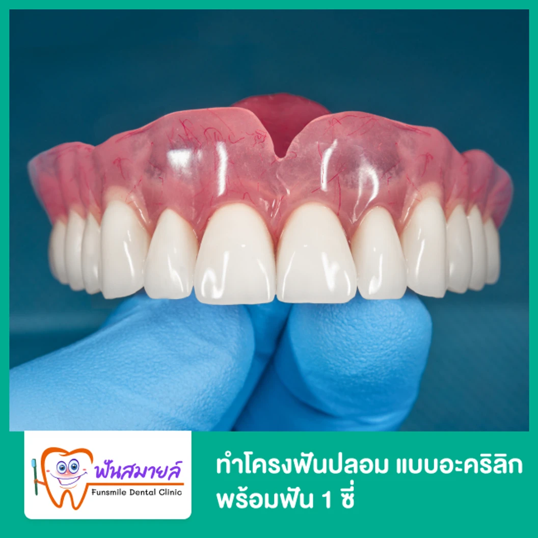 ทำโครงฟันปลอม แบบอะคริลิก พร้อมฟัน 1 ซี่