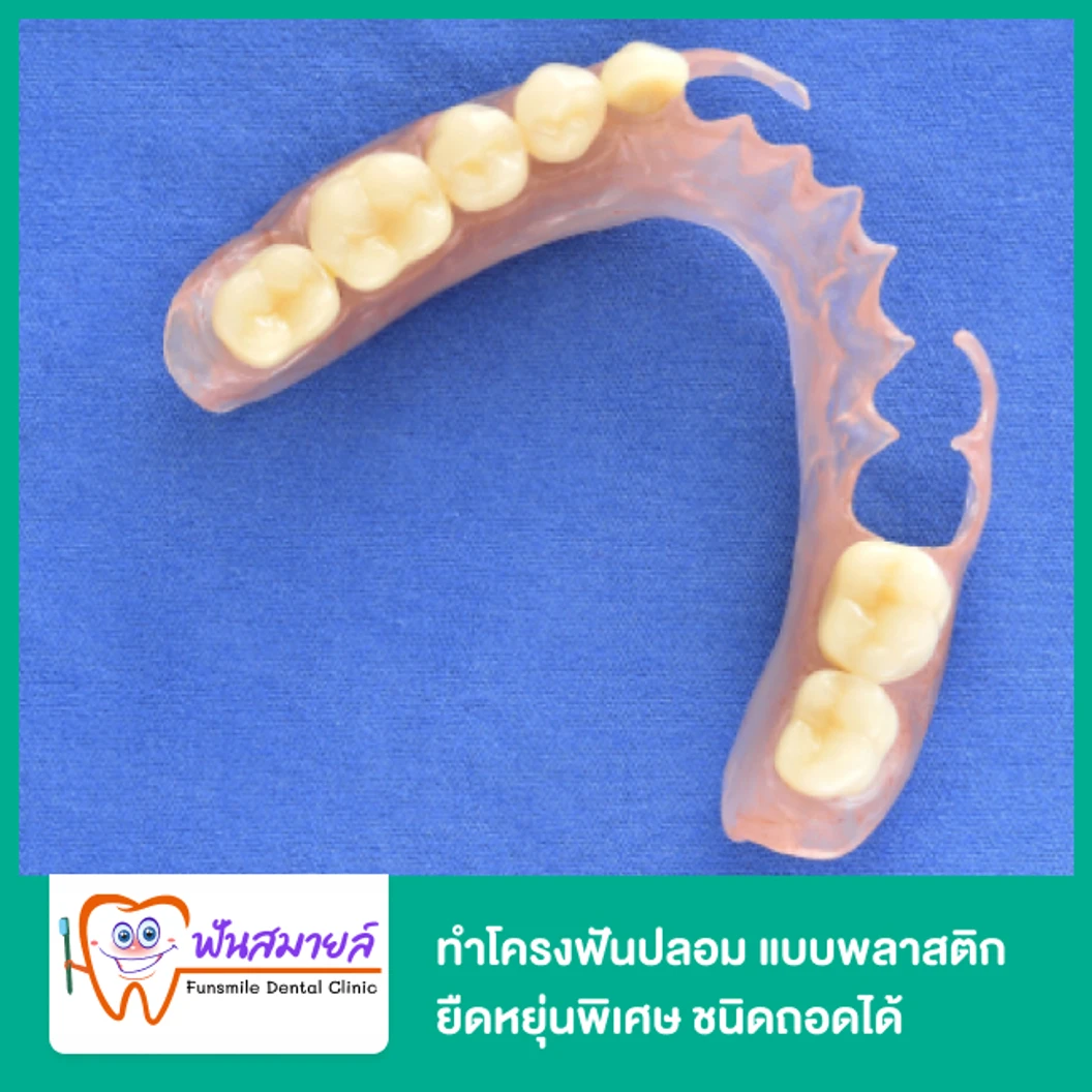ทำโครงฟันปลอม แบบพลาสติกยืดหยุ่นพิเศษ ชนิดถอดได้ พร้อมฟันซี่แรก 1 ซี่