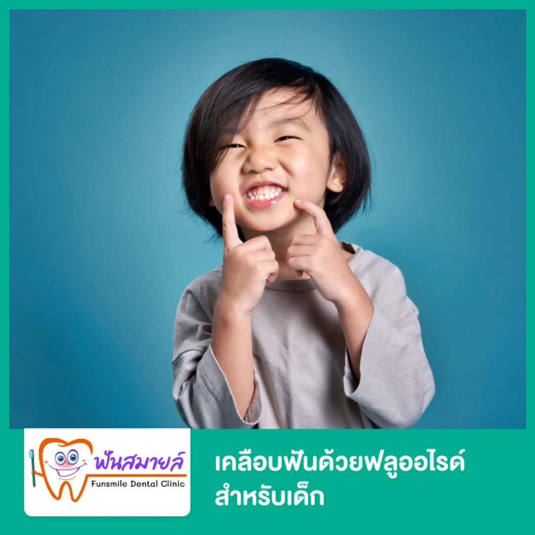 เคลือบฟันด้วยฟลูออไรด์ สำหรับเด็ก