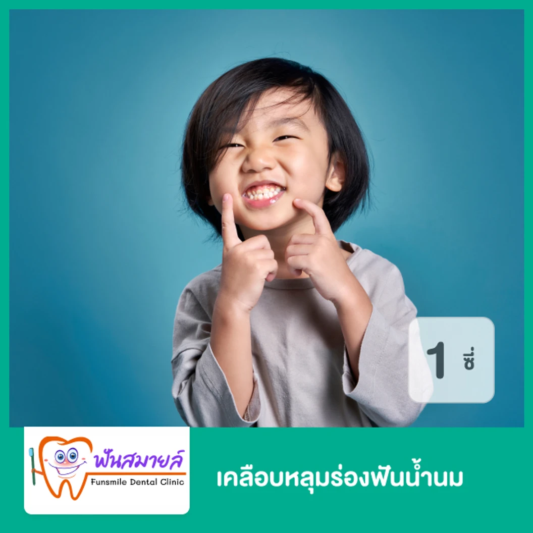 เคลือบหลุมร่องฟันน้ำนม สำหรับฟัน 1 ซี่