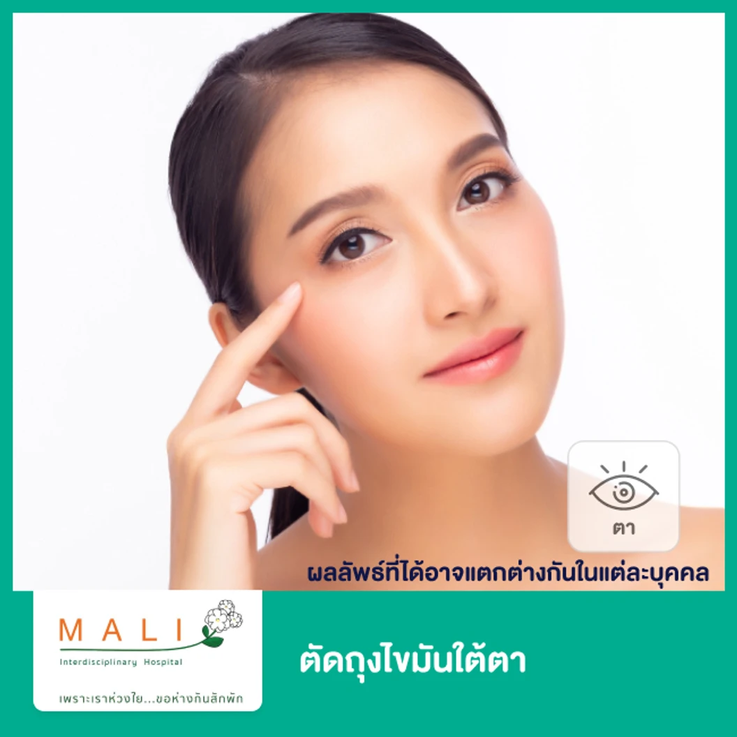 ตัดถุงไขมันใต้ตา 1 ครั้ง