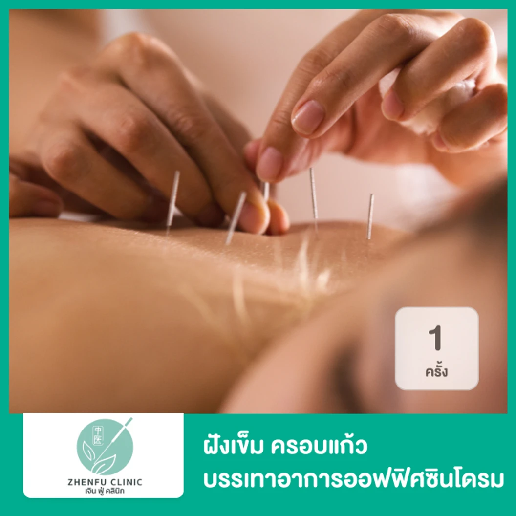 ฝังเข็ม ครอบแก้ว บรรเทาอาการออฟฟิศซินโดรม 1 ครั้ง