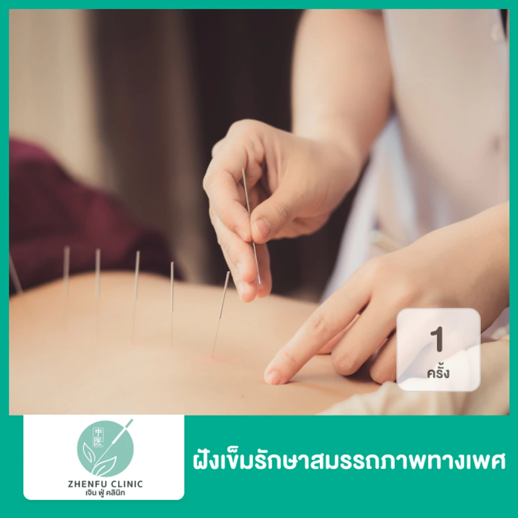 ฝังเข็มรักษาสมรรถภาพทางเพศ 1 ครั้ง