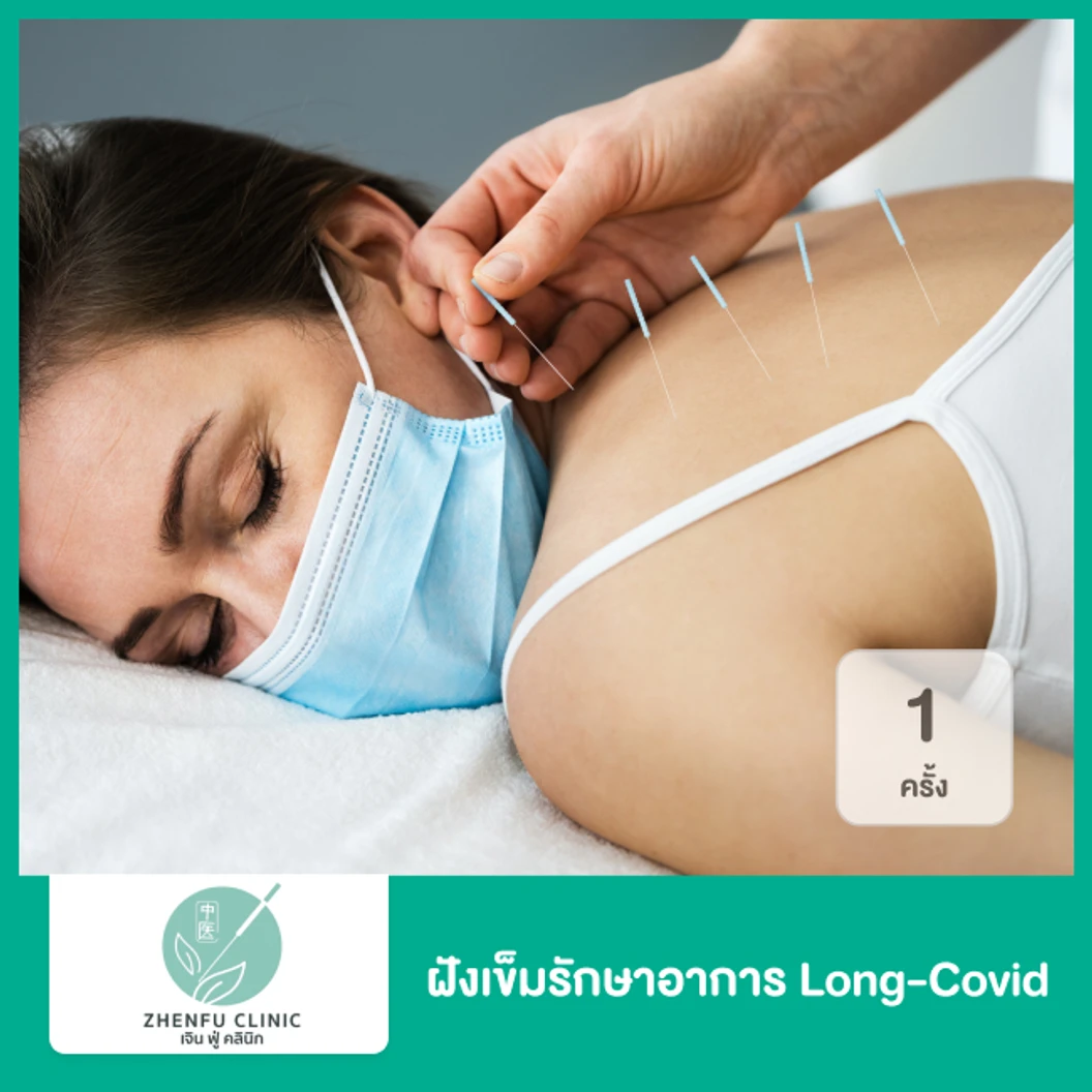 ฝังเข็มรักษาอาการ Long-COVID 1 ครั้ง