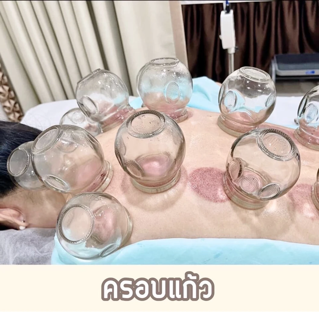 ฝังเข็มใบหน้า ลดฝ้า กระ 1 ครั้ง