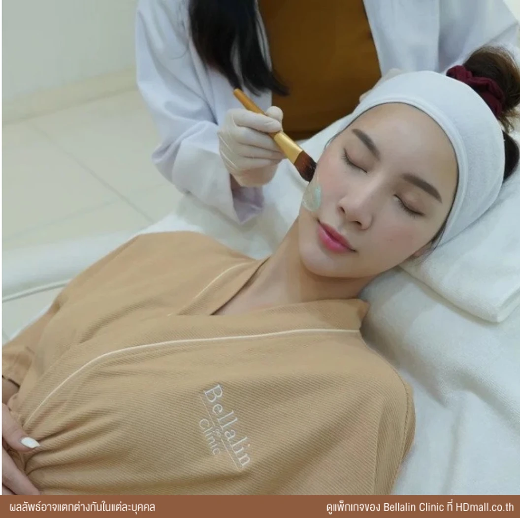 เลเซอร์ Q-Switch ปรับผิวให้กระจ่างใส และลดจุดด่างดำบนใบหน้าไม่จำกัดช็อต ขึ้นอยู่กับแพทย์ประเมิน 1 ครั้ง ฟรี! Collagen Mask 1 ครั้ง มูลค่า 1,500 บาท
