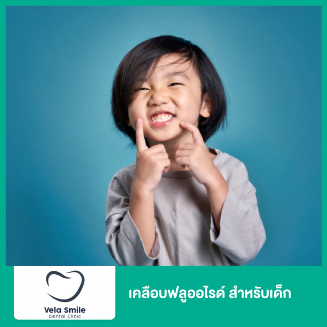 เคลือบฟลูออไรด์ สำหรับเด็ก