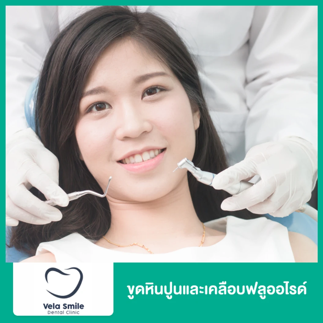 ขูดหินปูนและเคลือบฟลูออไรด์