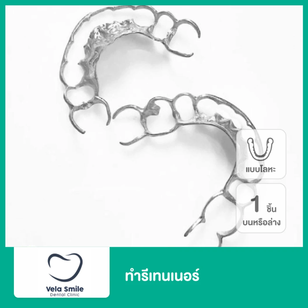 ทำรีเทนเนอร์แบบโลหะ 1 ชิ้น ฟันบนหรือล่าง