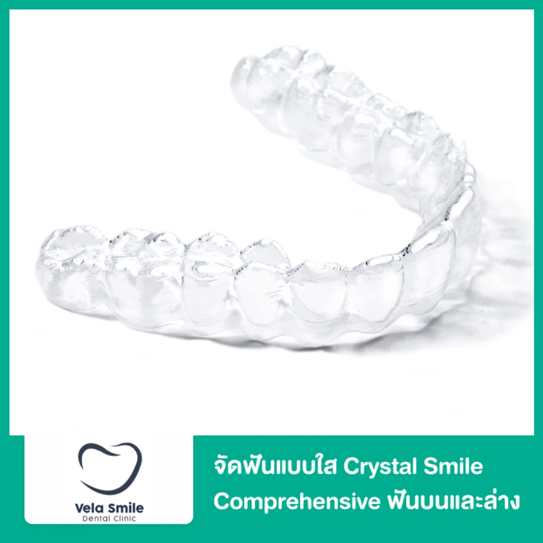 จัดฟันแบบใส Crystal Smile Comprehensive ฟันบนและล่าง