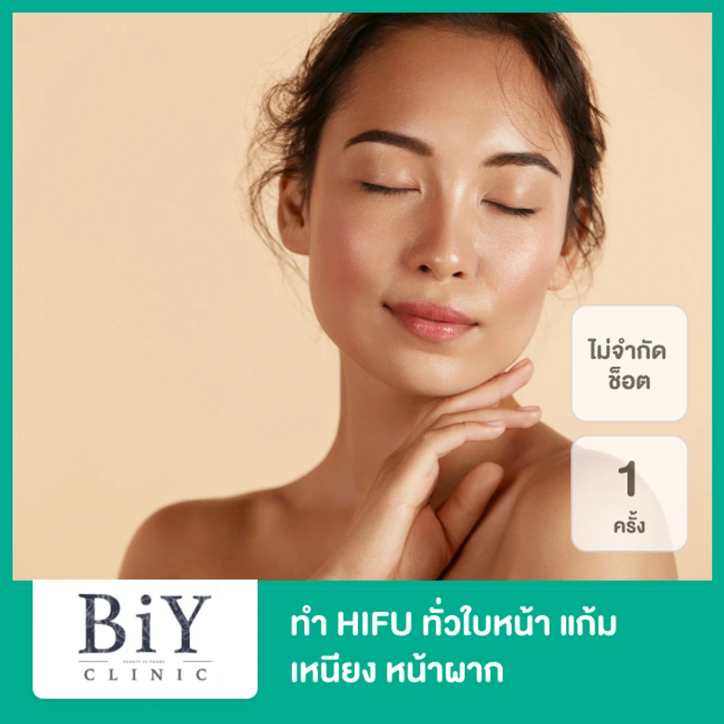 ทำ HIFU ไม่จำกัดช็อต ขึ้นอยู่กับแพทย์ประเมิน ทั่วใบหน้า แก้ม เหนียง หน้าผาก 1 ครั้ง