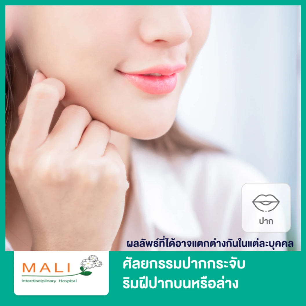 ศัลยกรรมปากกระจับ ริมฝีปากบนหรือล่าง