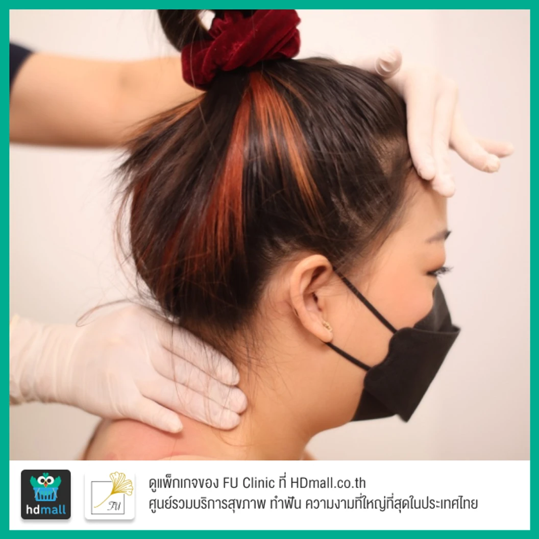 นวดกดจุดศีรษะ และ พอกสมุนไพรบรรเทาอาการปวดไมเกรนบริเวณตา 30 นาที พร้อมตรวจประเมิน 1 ครั้ง