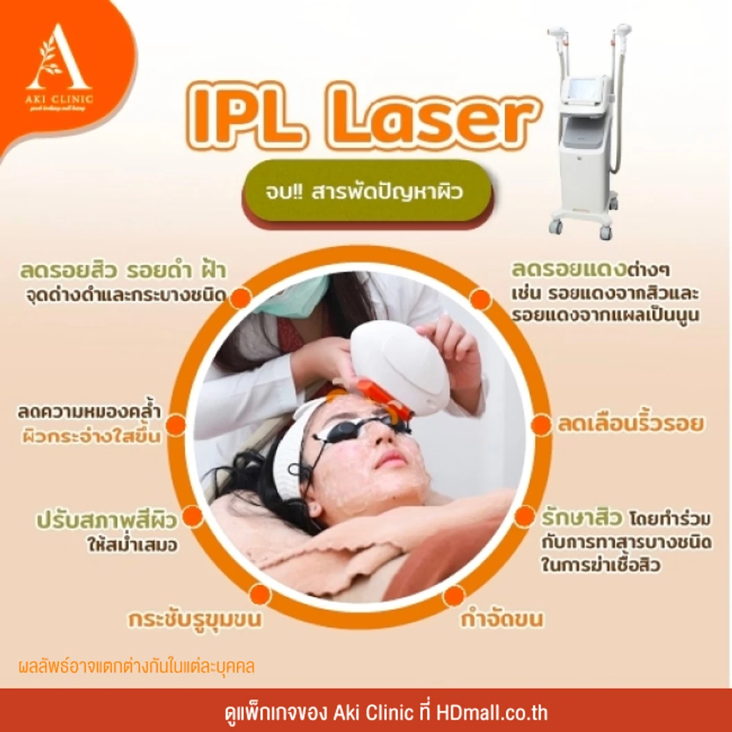 ทำ IPL บริเวณใบหน้า แก้ปัญหารอยดำ รอยแดง รอยสิว ปรับผิวสม่ำเสมอ 1 ครั้ง
