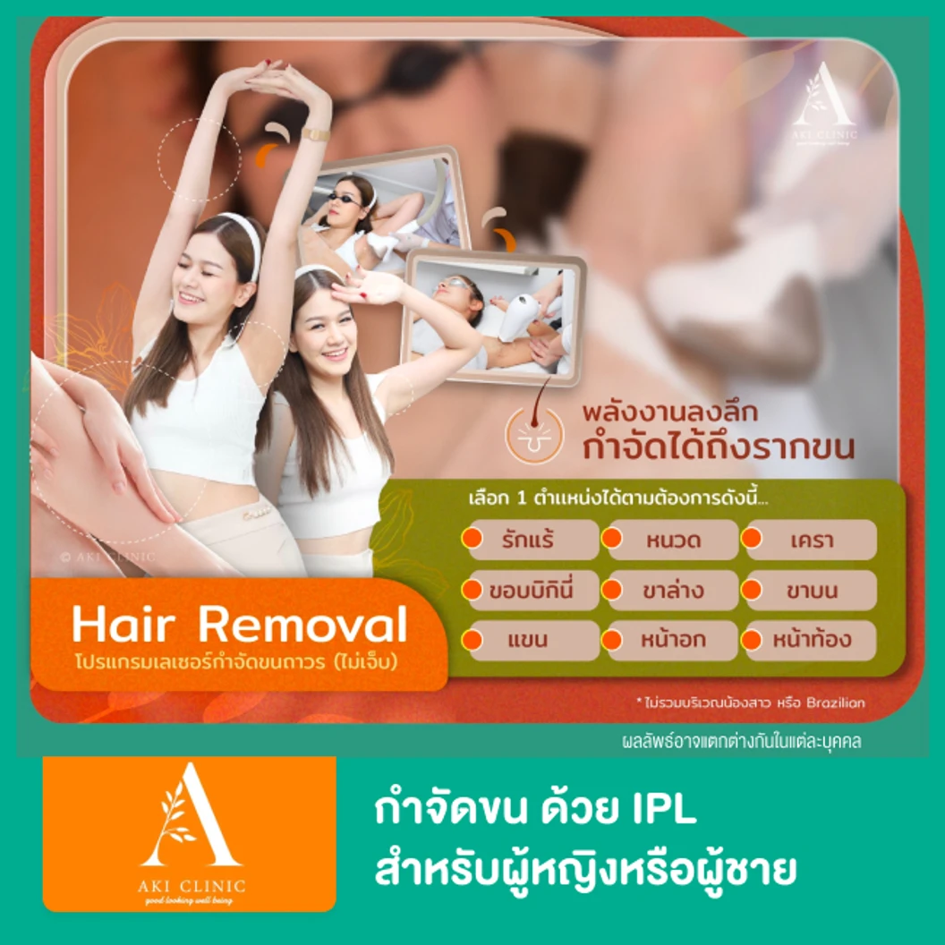 โปรแกรม IPL กำจัดขน 1 ครั้ง (เลือก 1 จุด)