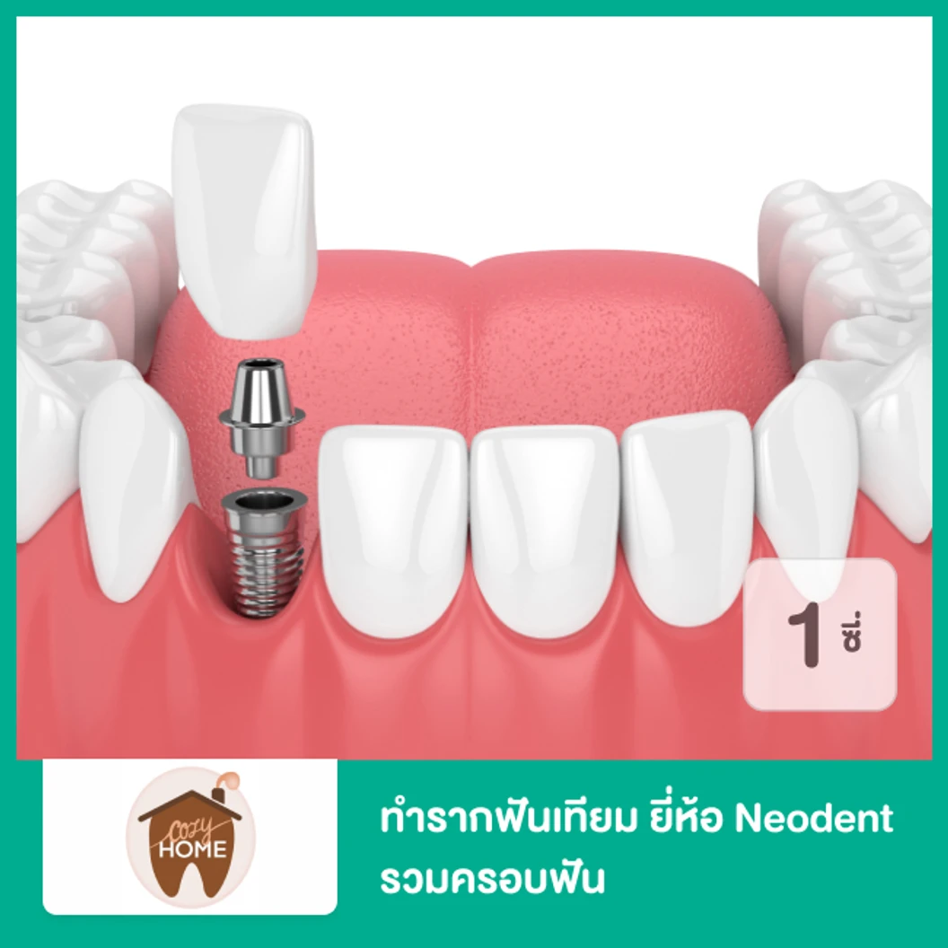 ทำรากฟันเทียม ยี่ห้อ Neodent รวมครอบฟัน สำหรับฟัน 1 ซี่