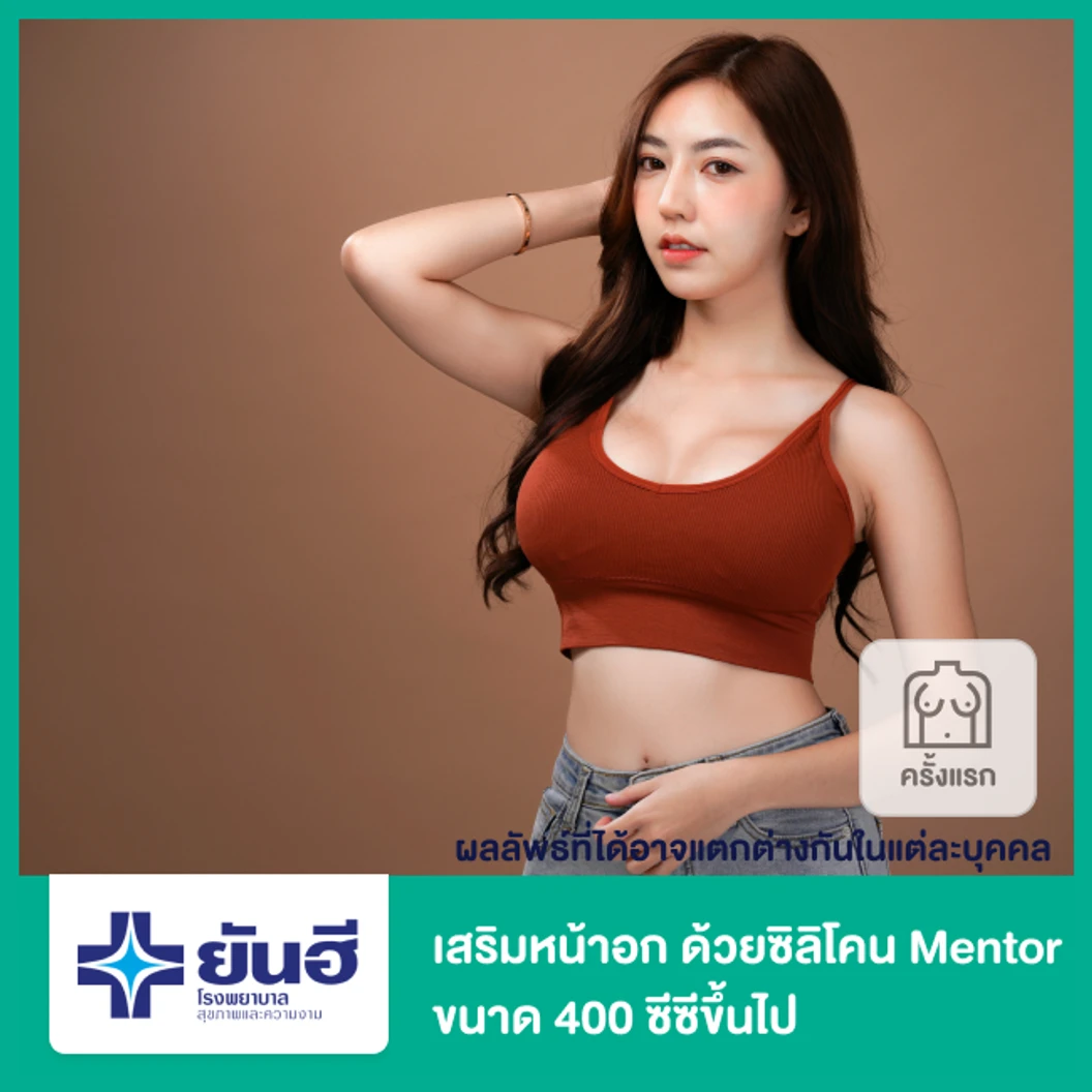 เสริมหน้าอก ด้วยซิลิโคน Mentor รุ่น Siltex-Smooth ขนาด 400 ซีซีขึ้นไป สำหรับเคสทำครั้งแรก