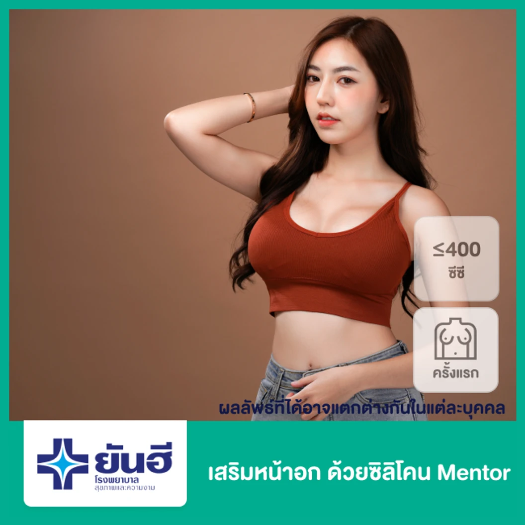 เสริมหน้าอก ด้วยซิลิโคน Mentor รุ่น X-TRA Gel ขนาดไม่เกิน 400 ซีซี สำหรับเคสทำครั้งแรก