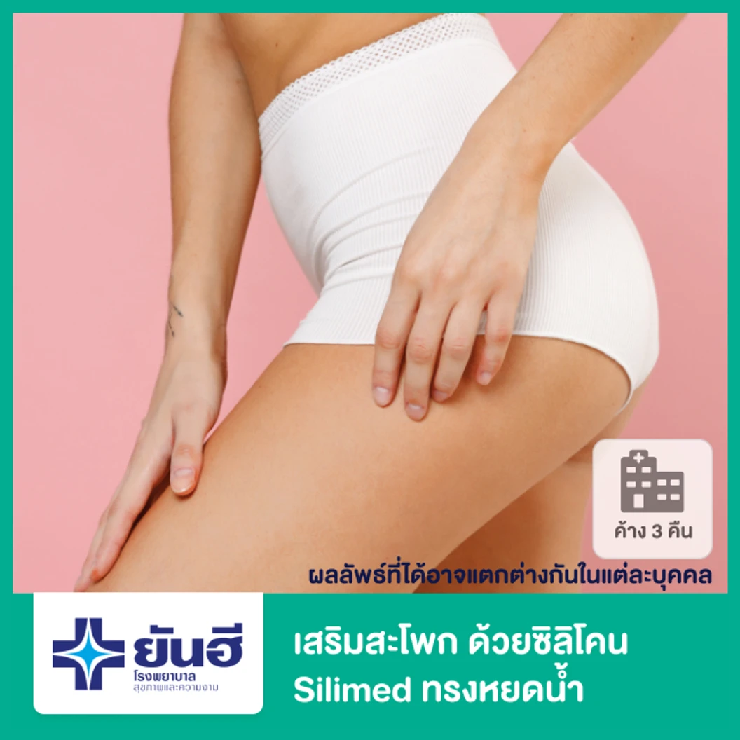 เสริมสะโพก ด้วยซิลิโคน Silimed ทรงหยดน้ำ นอนพักที่ รพ. 3 คืน