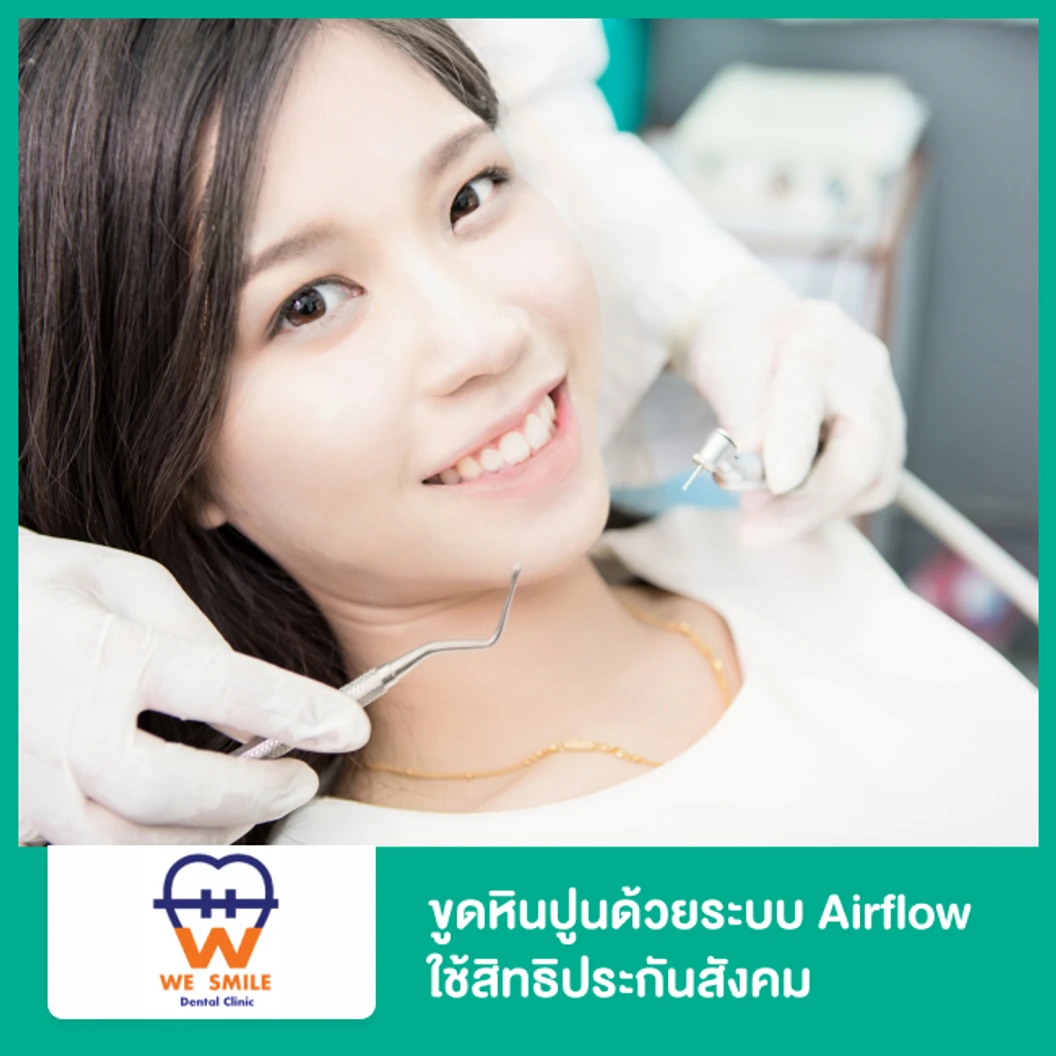 ขูดหินปูน ขัดฟันด้วยระบบ Airflow ใช้สิทธิประกันสังคม