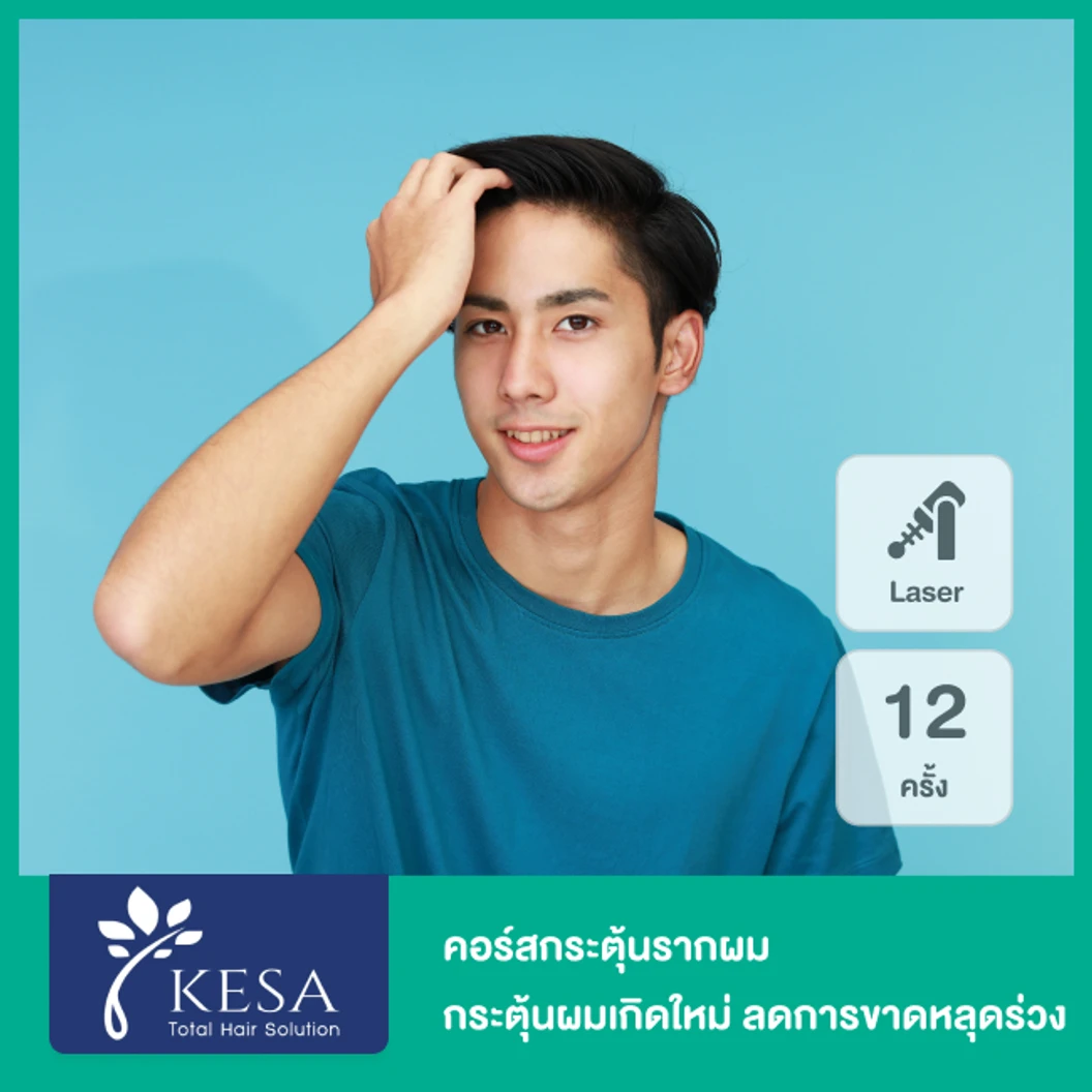 คอร์สกระตุ้นรากผม กระตุ้นผมเกิดใหม่ ลดการขาดหลุดร่วง ด้วยเลเซอร์ HEALITE II เทคโนโลยี Low Level Laser Light Therapy (LLLT) 12 ครั้ง